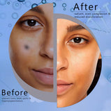 2% Kojic Acid Serum - 30 ML