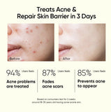 DermaCure 2% Salicylic Acid Face Serum – Acne & Spot Reduction, Oil Control, Pore Minimizer with Gotu Kola, Hemp & Witch Hazel