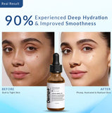 Apricot Kernel Oil | Natural, Cold-Pressed | Morocco Imported | Deep moisturization | Anti-aging | 30ml | UV Protected Packaging