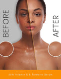 20% Vitamin C & Turmeric Serum