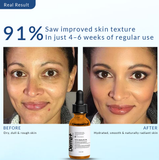 100% Natural Pure Soya Squalane Oil