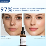 100% Organic Sea Buckthorn Cold-Pressed Oil