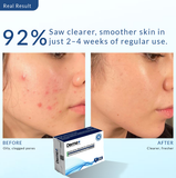 Derma+ Salicylic Acid 2% Soap Anti-Acne Smooth Skin 125g Bar