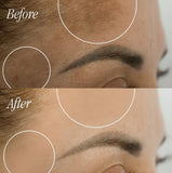 0.3% Tranexamic Acid Serum