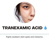 0.3% Tranexamic Acid Serum