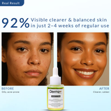 Prince’s Pear Balancing Oil