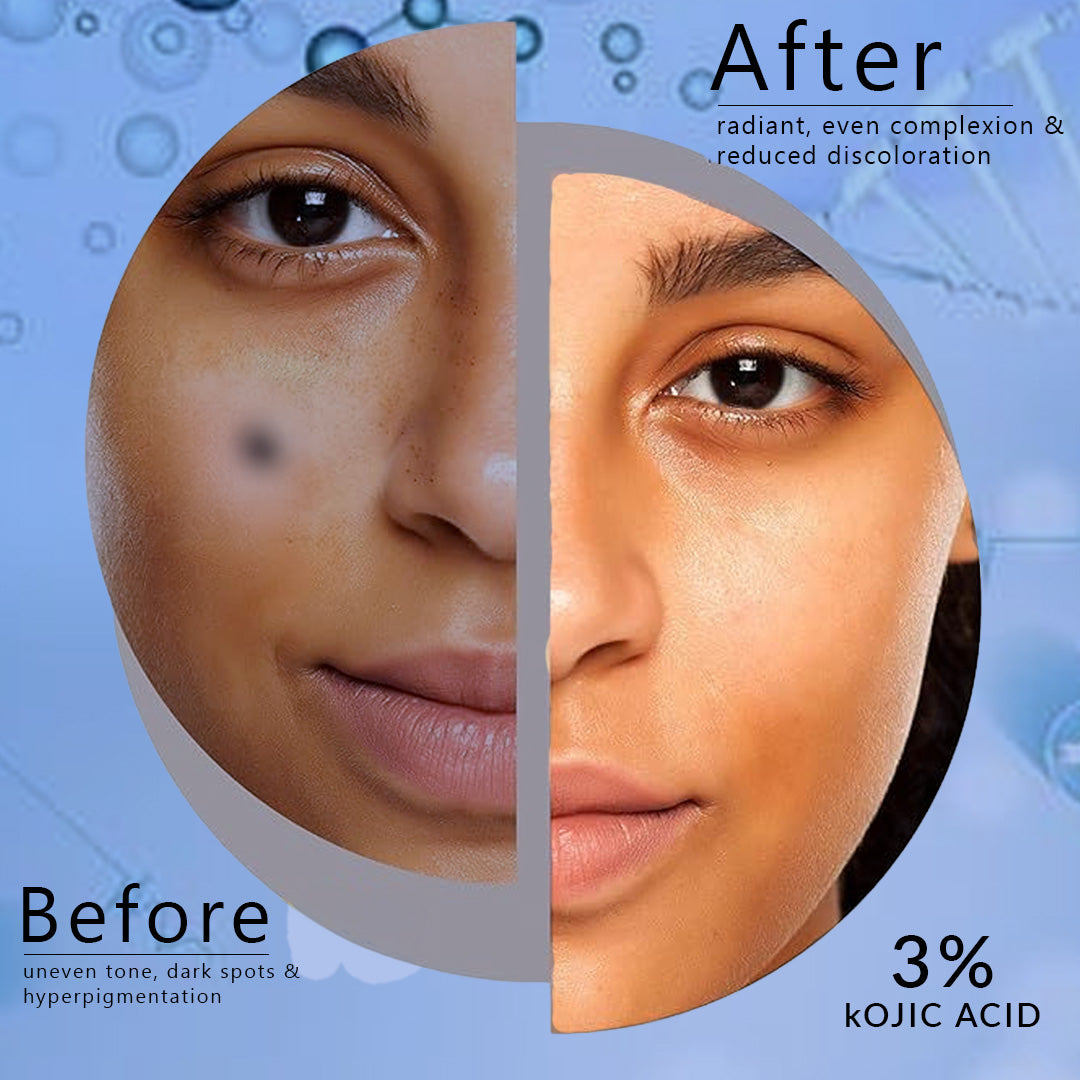 3% Kojic Acid Glutathione Face Serum – Dermacure 3% Kojic Acid Glutathione Face Serum – Dermacure