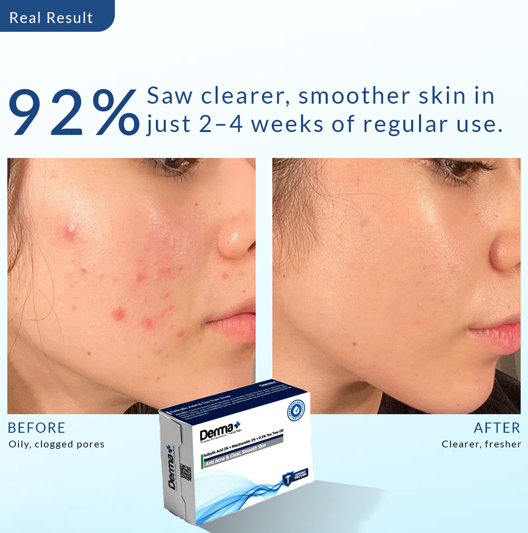 Derma+ Acne Control Soap